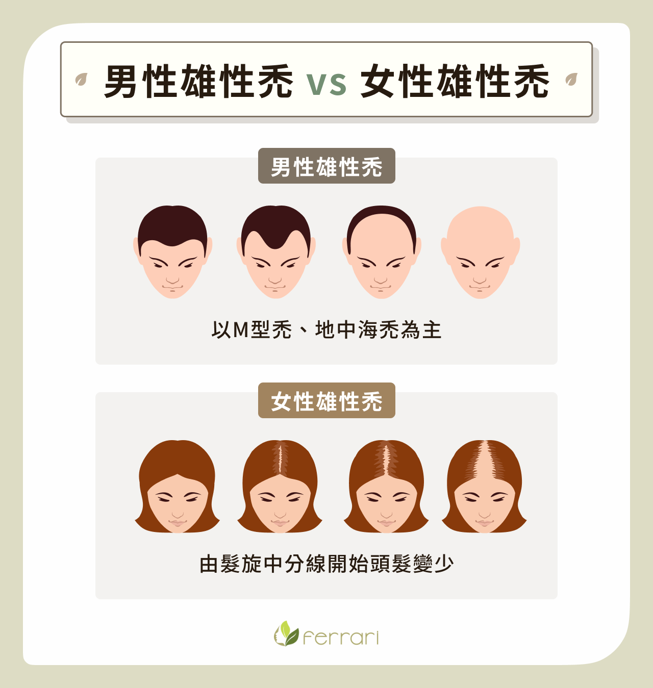 男性雄性禿 vs 女性雄性